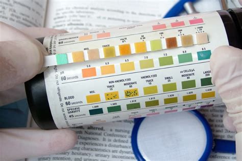What Normal (and Abnormal) Urine Test Results Reveal .